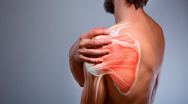 Polimialgia reumática