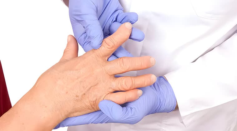 Diagnóstico y manejo de artritis reumatoide