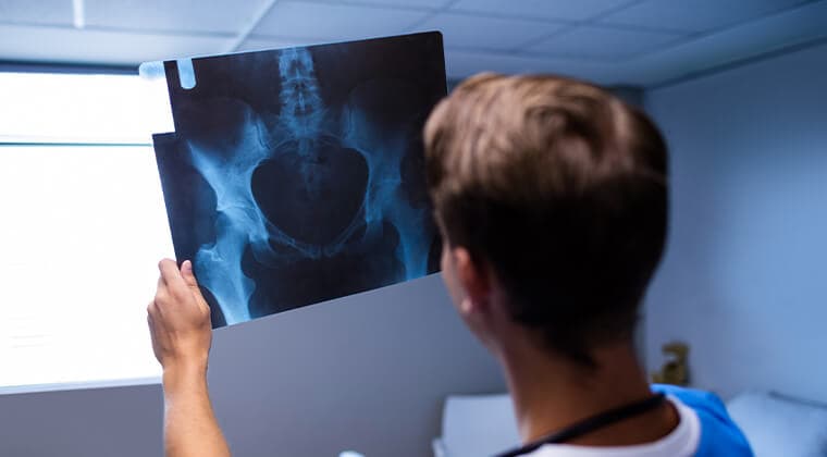Evaluación y manejo de osteoporosis